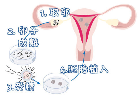 中国靠谱借卵代孕公司生殖医学中心